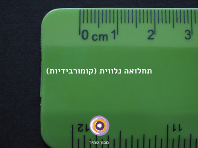 תחלואה נלווית (קומורבידיות)